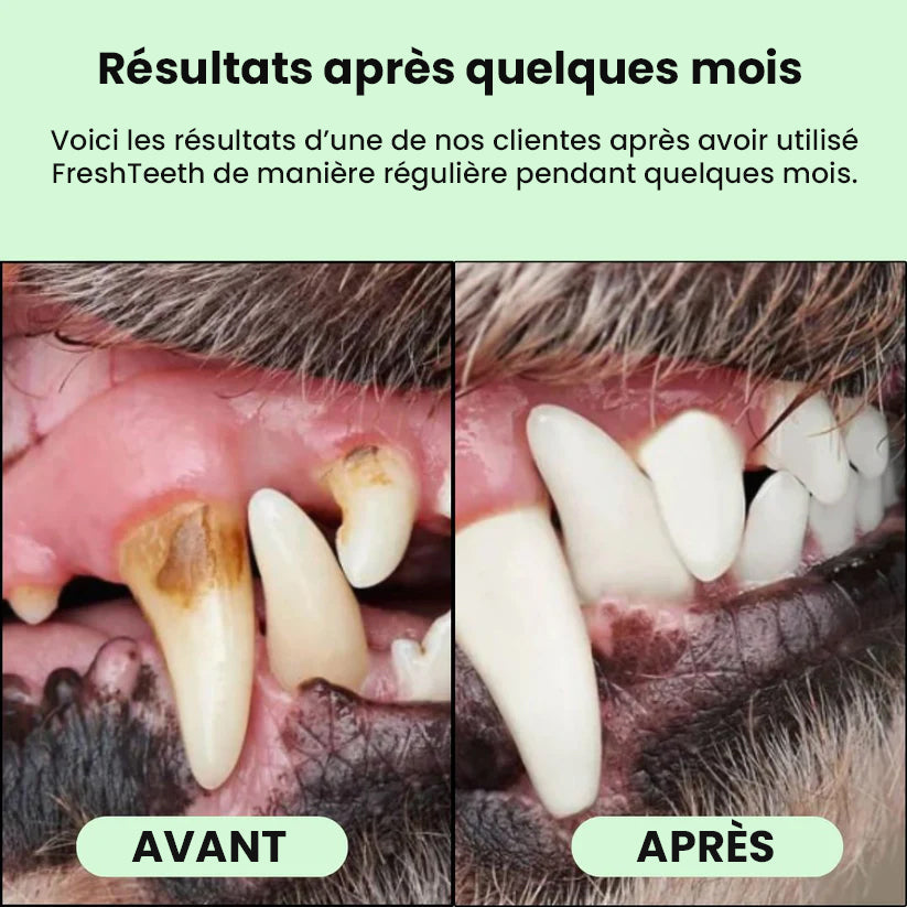 Lingettes bucco-dentaires FreshTeeth