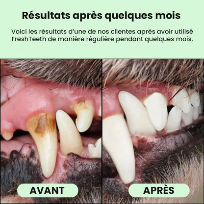 Lingettes bucco-dentaires FreshTeeth